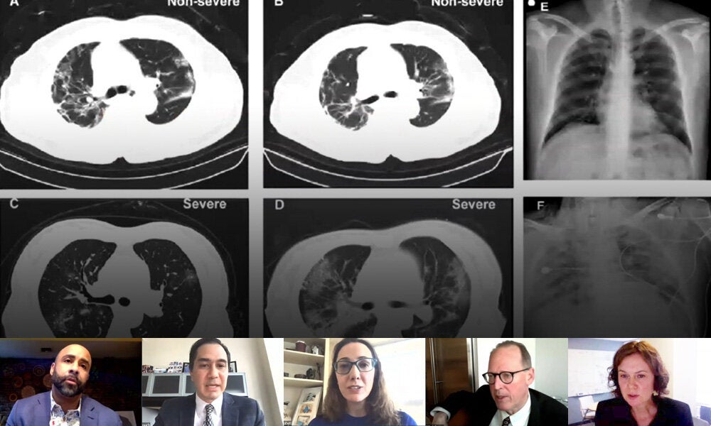 Scientists on Zoom call viewing x-rays