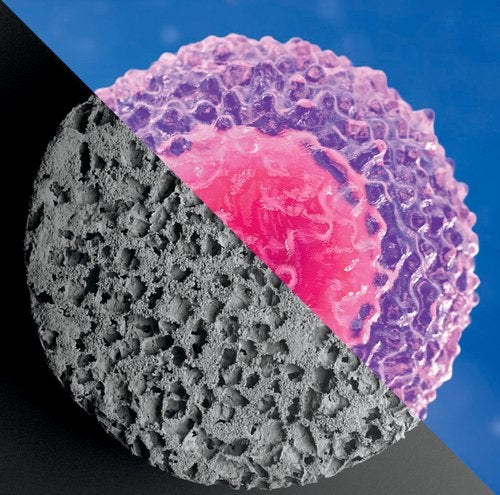Image of cancer cell