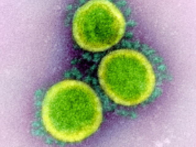 Transmission electron micrograph of SARS-CoV-2 virus particles