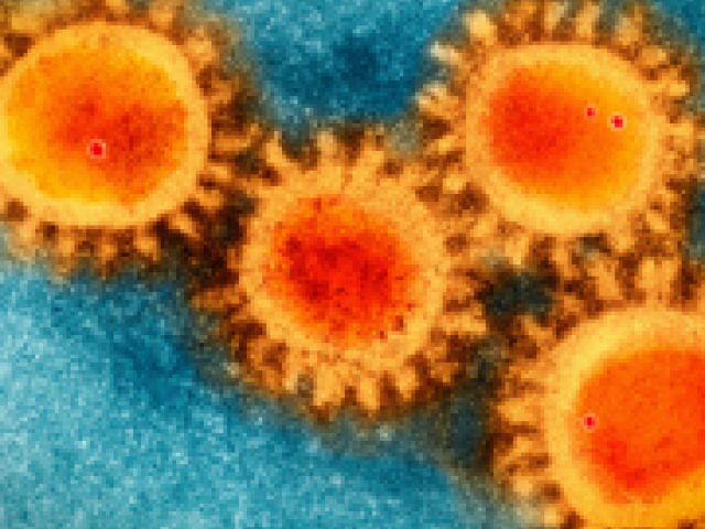 An electron microscopy photo of the coronavirus COVID-19