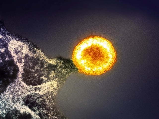 Colorized transmission electron micrograph of an HIV-1 virus particle (yellow/gold) budding from an infected cell